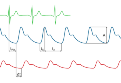 Pulse Wave Parameters